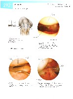 Sobotta  Atlas of Human Anatomy  Trunk, Viscera,Lower Limb Volume2 2006, page 299